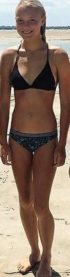 Parece Brea